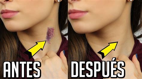 como hacer un chupetón que dure mucho|Cómo Hacer Chupetones en el Cuello: Guía Paso a。